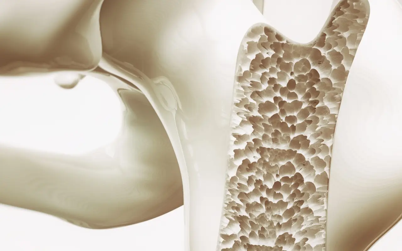 Soffri di osteoporosi? Ecco il formaggio che devi assolutamente mangiare per rinforzare le ossa